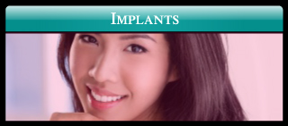 Implants