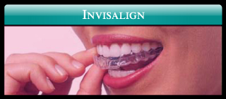 Invisalign